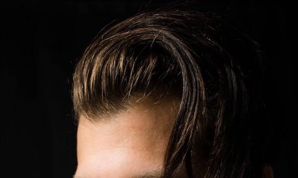 hair transplant in turkey